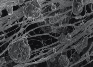 CENS Materials, a portfolio company of INCUBIT, Elbit Systems’ deep-tech incubator, raises $1.5 million CENS carbon nanotubes micro electron microscopy